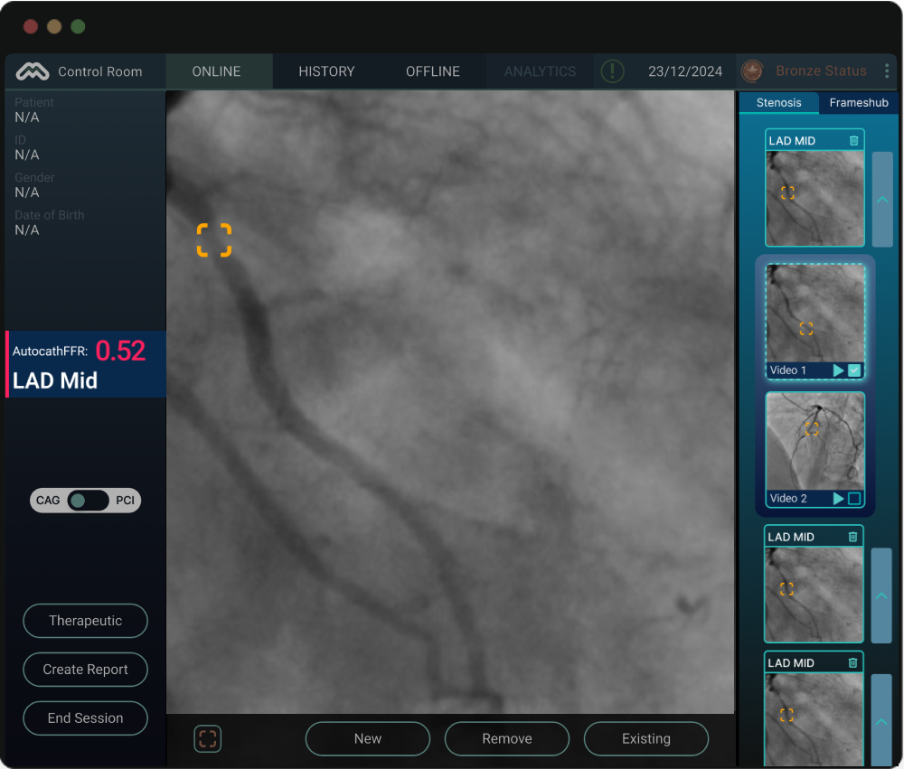 Old UI: manual artery selection