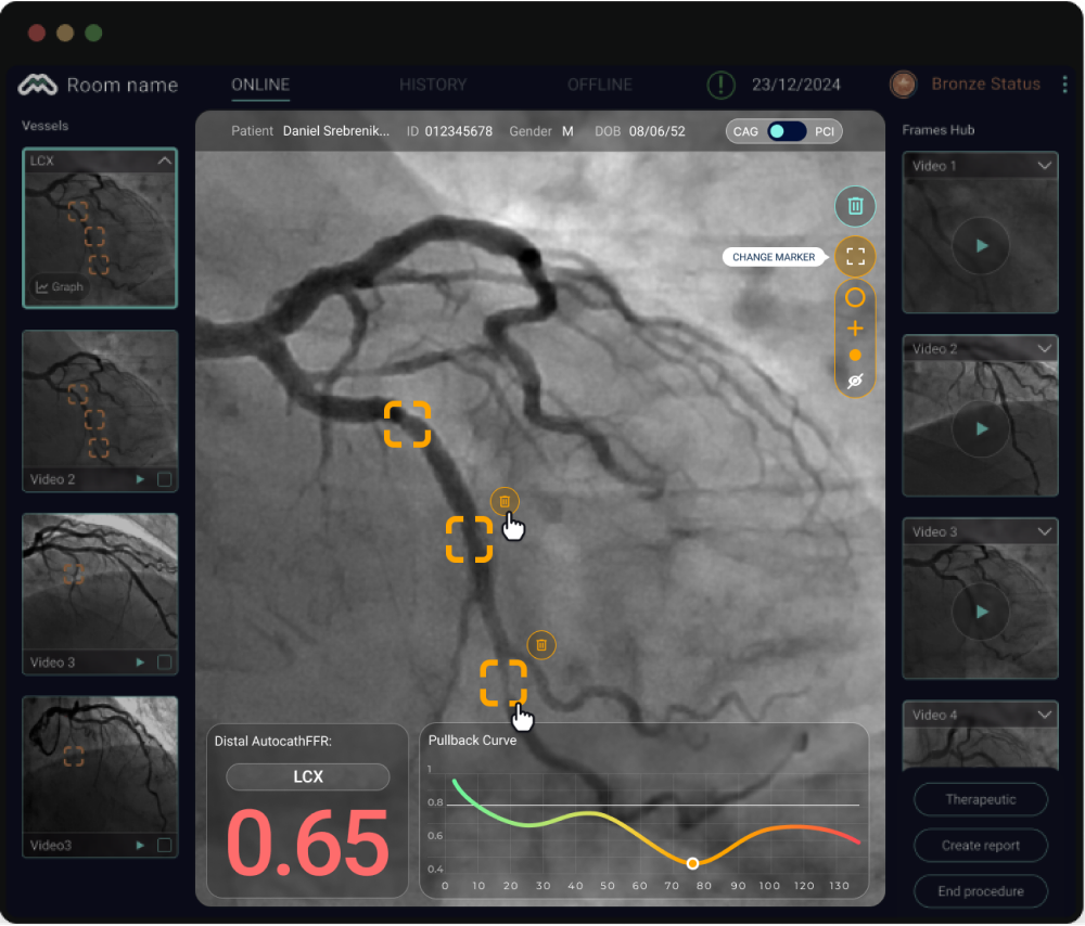 New UI: controls at the surface